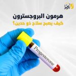 هرمون البروجسترون وأهميته في الحمل والحقن المجهري | منصة زينة