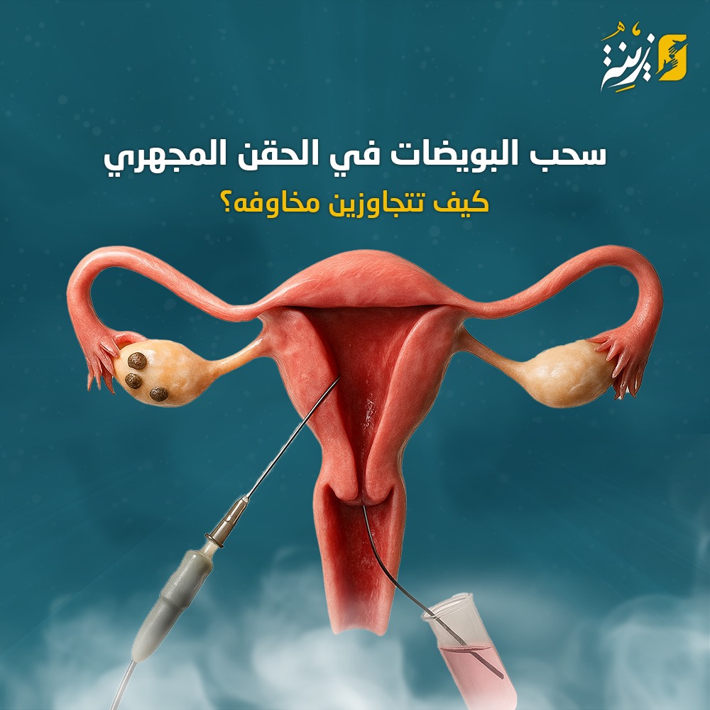 يوم سحب البويضات في الحقن المجهري، كيف تتجاوزين مخاوفه