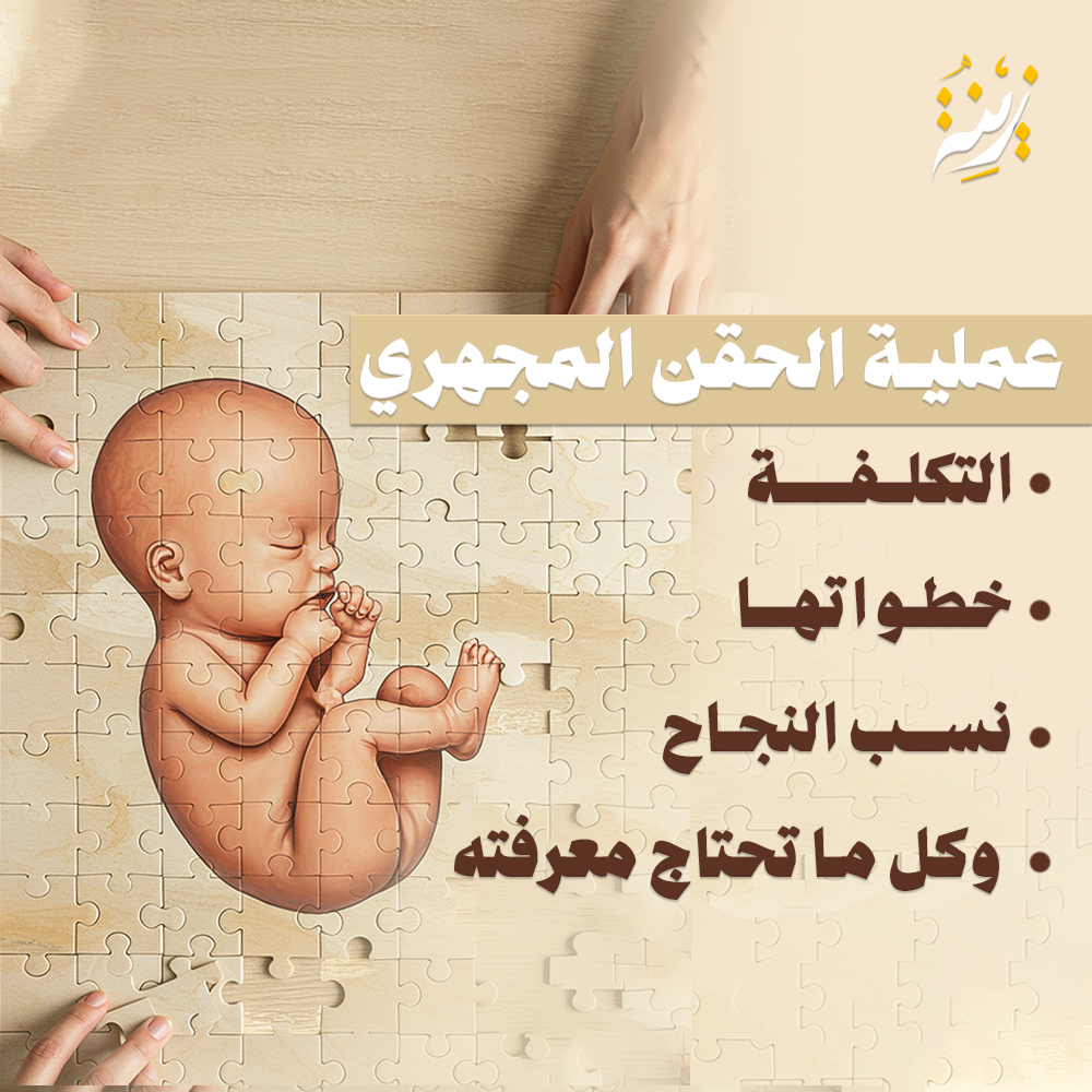 تعرفي على خطوات عملية الحقن المجهري، وكل ما تحتاجين معرفته